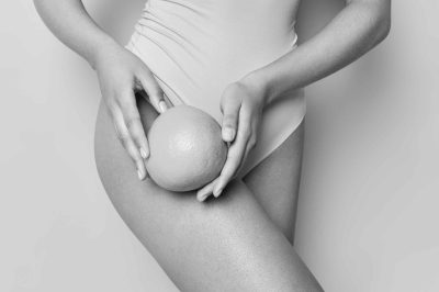 BLACK FRIDAY -50% Smooth Confidence - MedSpaLife Webshop 